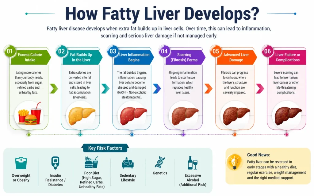 Educational infographic showing the stages of fatty liver development: excess calorie intake, fat buildup, inflammation, fibrosis, advanced liver damage, and liver failure, with key risk factors and healthy lifestyle tips, in a blue and green color scheme, landscape format."
